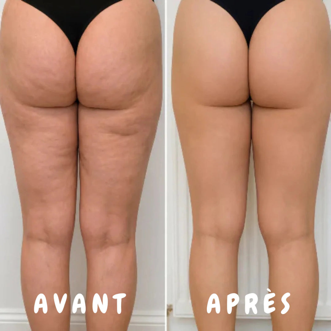 LEGAZEN™ | Masseur Électrique 2-en-1 Corps Complet
